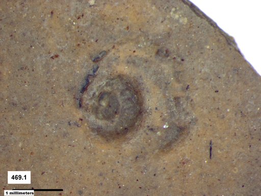 Gastropoda