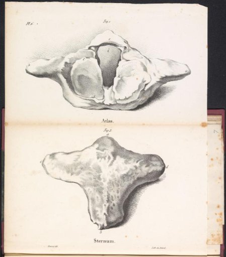 Atlas and Sternum of a Whale, 1827