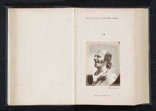 Portrait of a subject during electrical stimulation: 'un vieillard'