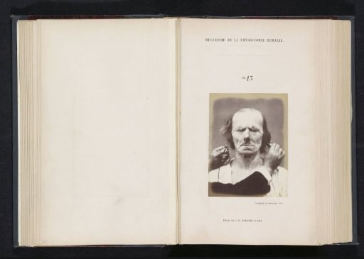 Portrait of a test subject during electrical stimulation: 'an old man'