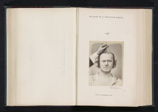 Portrait of a test subject during electrical stimulation: 'an old man'