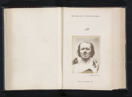 Portrait of a test subject during electrical stimulation: 'an old man'