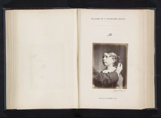 Portrait of a test subject during electrical stimulation: 'a little girl aged eight'
