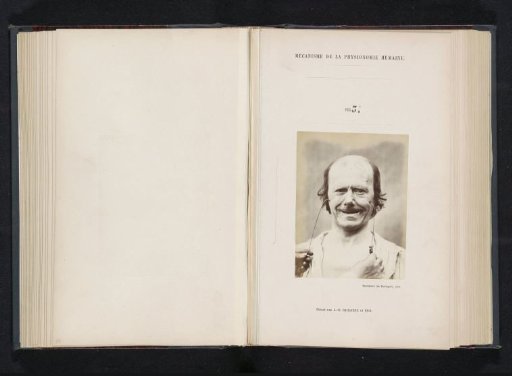 Portrait of a test subject during electrical stimulation: 'an old man'