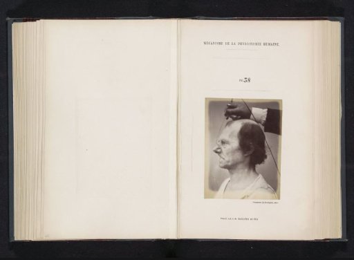 Portrait of a test subject during electrical stimulation: 'an old man'