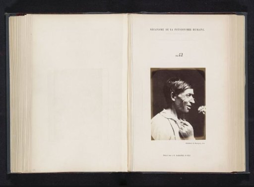 Portrait of a test subject during electrical stimulation: 'un homme âgé de quarante-deux'