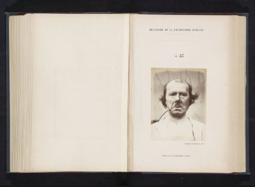 Portrait of a test subject during electrical stimulation: 'un vieillard'