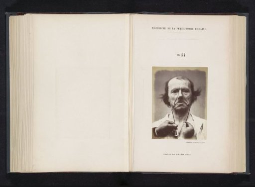 Portrait of a test subject during electrical stimulation: 'un vieillard'