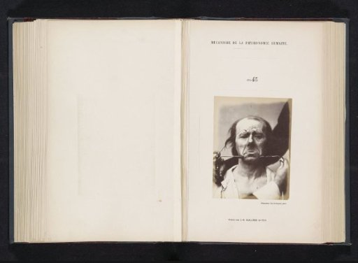 Portrait of a test subject during electrical stimulation: 'un vieillard'