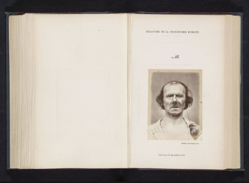 Portrait of a test subject during electrical stimulation: 'un vieillard'