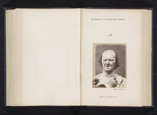 Portrait of a test subject during electrical stimulation: 'un vieillard'