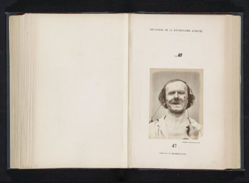 Portrait of a test subject during electrical stimulation: 'un vieillard'