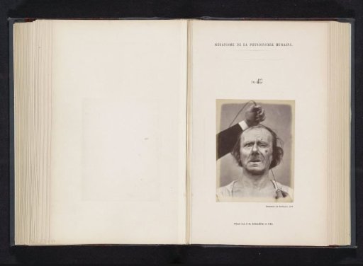 Portrait of a test subject during electrical stimulation: 'un vieillard'