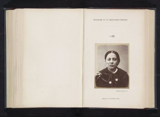 Portrait of a test subject during electrical stimulation: 'une jeune femme'
