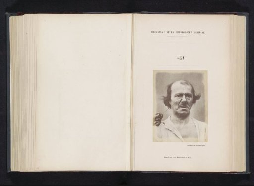 Portrait of a test subject during electrical stimulation: 'un vieillard'