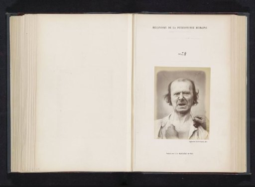 Portrait of a test subject during electrical stimulation: 'un vieillard'