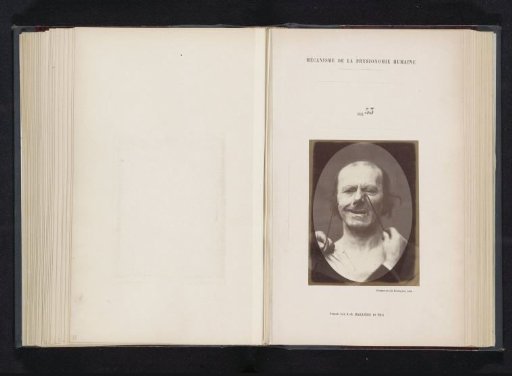Portrait of a test subject during electrical stimulation: 'un vieillard'