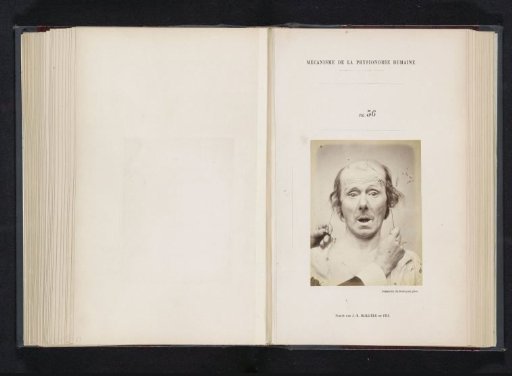 Portrait of a test subject during electrical stimulation: 'un vieillard'