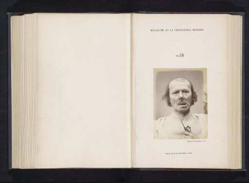 Portrait of a test subject during electrical stimulation: 'un vieillard'