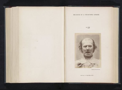 Portrait of a test subject during electrical stimulation: 'un vieillard'