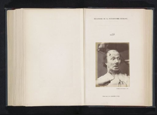 Portrait of a test subject during electrical stimulation: 'un vieillard'