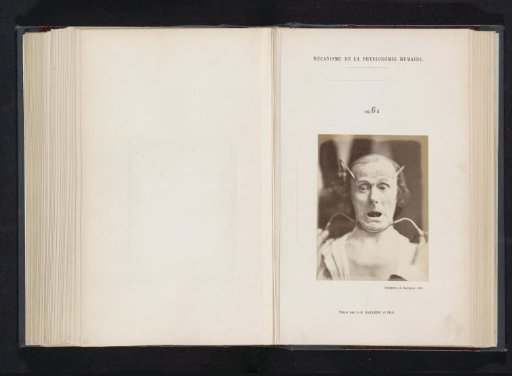 Portrait of a test subject during electrical stimulation: 'un vieillard'