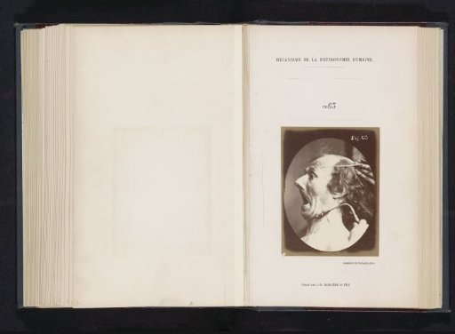 Portrait of a test subject during electrostimulation: 'un vieillard'