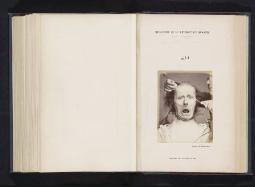Portrait of a test subject during electrostimulation: 'un vieillard'