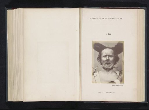 Portrait of a test subject during electrostimulation: 'un vieillard'