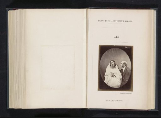 Portrait of G.B.A. Duchenne and test subject 'la jeune fille' during electrostimulation