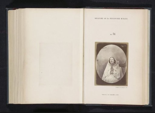 Portrait of a test subject during electrostimulation: 'la jeune fille'