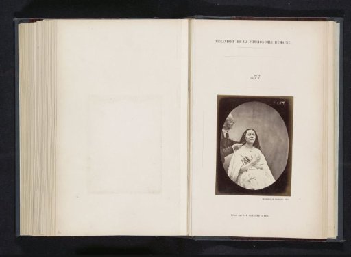 Portrait of G.B.A. Duchenne and test subject 'la jeune fille' during electrostimulation