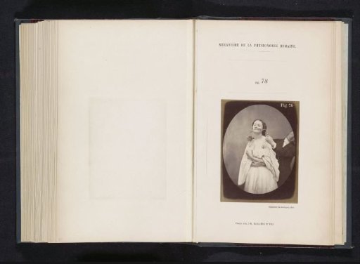 Portrait of G.B.A. Duchenne and test subject 'la jeune fille' during electrostimulation