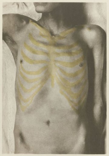 Anatomical photograph of a male corpse: 'The form of the chest in relation to the skeleton' (Die Form der Brust in ihren Beziehungen zum Skelette)
