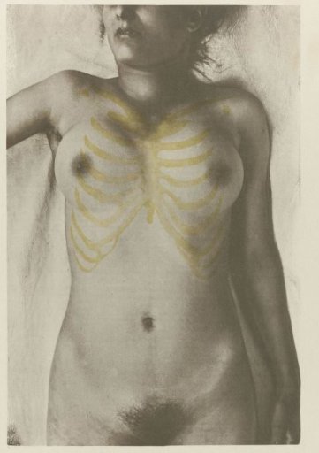 Anatomical photograph of a female corpse: "The form of the breast in relation to the skeleton"
