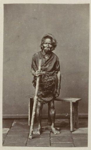 Portrait of a beggar