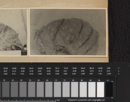 Pathological anatomy