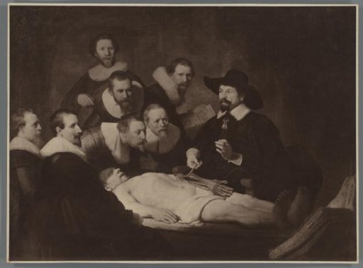 Photographic reproduction of the painting The Anatomy Lesson of Dr. Nicolaes Tulp by Rembrandt van Rijn