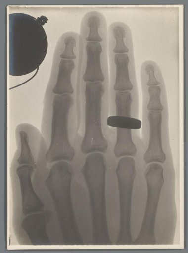 Hand with ring on the ring finger