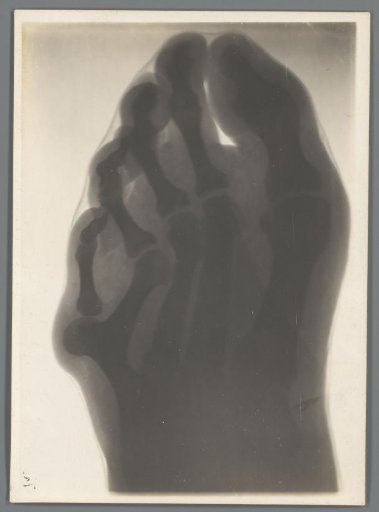 Foot