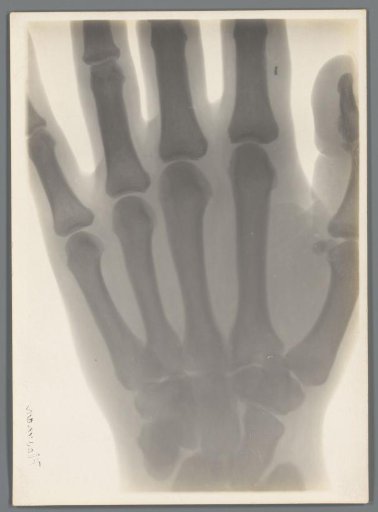 Hand