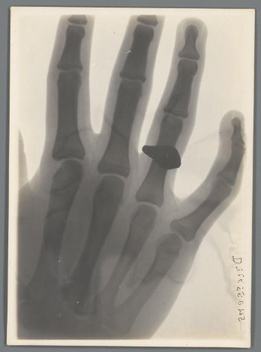 Left hand with ring on the ring finger