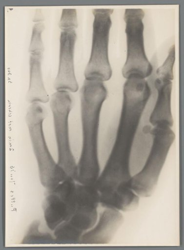 Right hand