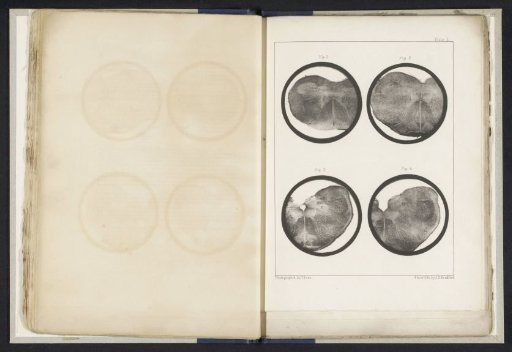 Four details of a medulla oblongata of a sheep
