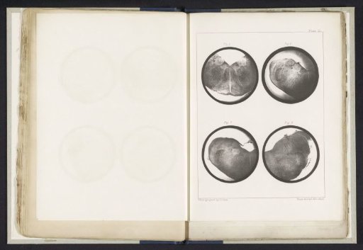 Four cross-sections of a medulla oblongata of a sheep