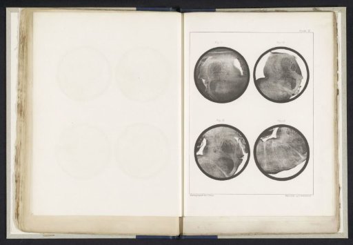 Four Details of a Medulla Oblongata of a Sheep