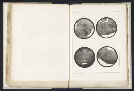 Four Details of a Medulla Oblongata of a Sheep