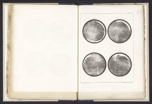 Four Details of a Medulla Oblongata of a Human
