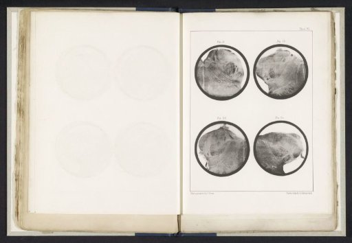 Four Details of a Medulla Oblongata of a Human