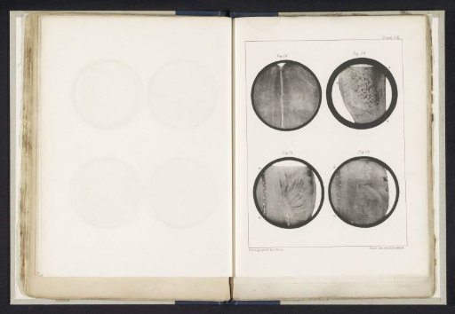 Four Longitudinal and Transverse Sections of a Medulla Oblongata of a Human